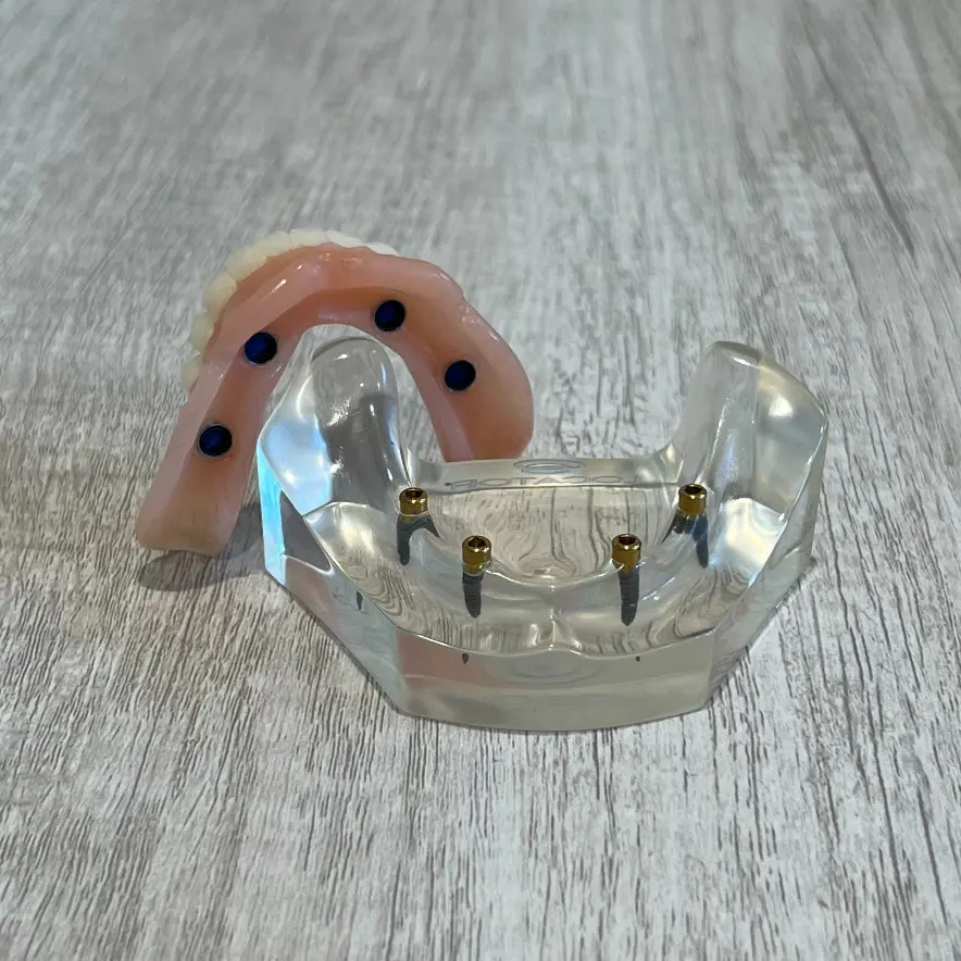 snap-in implant dentures Punta Gorda, FL